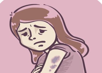 Opgelet! Hierom heb je sneller blauwe plekken als je ouder bent