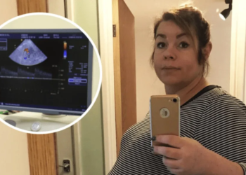 Vrouw lukt het 8 jaar lang niet om zwanger te worden. Als dokter echo maakt valt ze flauw