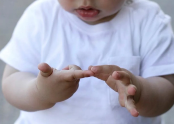 Een baby met een staart of extra vinger, deze bijzondere afwijking komt vaak voor