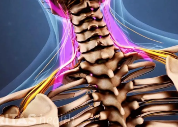 SUPERTIP: Slaap eens een nacht zonder kussen en zie wat er gebeurt