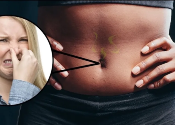 Last van een vieze geur uit jouw navel? Dit moet je erover weten