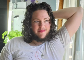 Mensen noemen mijn baard walgelijk, maar ik vind het heerlijk om een vrouw met een harige kin te zijn
