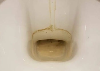 Met deze huismiddelen voorkom je bruine aanslag
