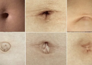 Dit is wat het soort navel dat je hebt vertelt over je persoonlijkheid