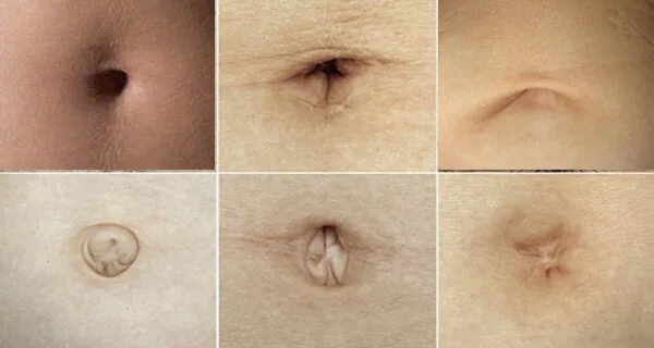 Dit is wat het soort navel dat je hebt vertelt over je persoonlijkheid