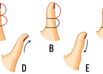 De vorm van je duim onthult jouw persoonlijkheid, klopt het bij jou?