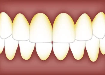 Tandartsen leggen uit: eet deze dingen niet om gele tanden te vermijden
