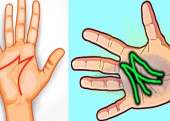 Dit betekent het als je een ‘M’ in de palm van je hand hebt! (het is echt zo)