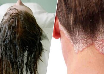 Let op! Dit is waarom je nooit met nat haar moet gaan slapen