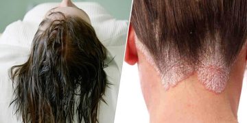 Let op! Dit is waarom je nooit met nat haar moet gaan slapen