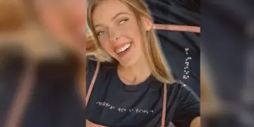 Chelsea (22) deelt haar ervaring met een zeldzame aandoening: “Dagelijks krijg ik opmerkingen over mijn gezicht”