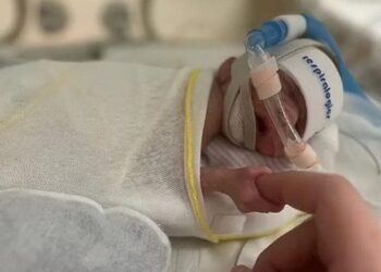 Klein maar een vechtertje! Prematuur geboren baby van 450 gram keert na 181 dagen ziekenhuis eindelijk huiswaarts