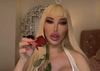 Jessica kiest voor stemoperatie om haar zware stem vrouwelijker te maken