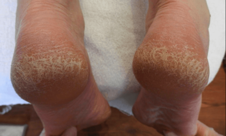 VapoRub is meer dan een middel tegen verkoudheid – 9 manieren om dit geweldige goedje te gebruiken