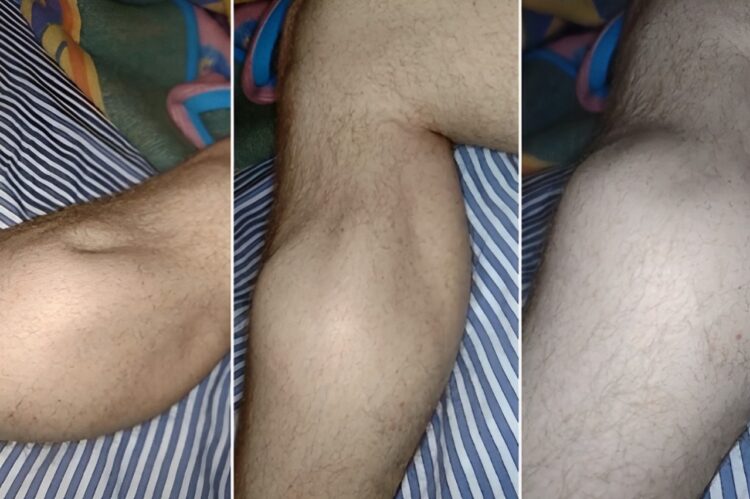 Kramp in je kuiten en tenen tijdens het slapen? Dit kun je doen!