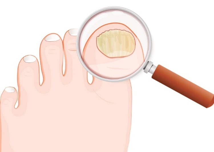 VapoRub is meer dan een middel tegen verkoudheid – 9 manieren om dit geweldige goedje te gebruiken