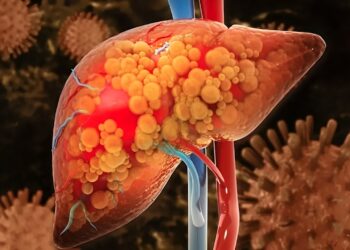 Negeer de signalen van een vervette lever niet! Zo herken je het…