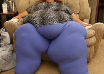 Zij was bekend als ’s werelds dikste vrouw.. Zo ziet ze er nu op dit moment uit