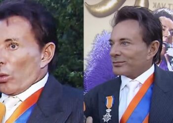Gerard Joling reageert fel en haalt uit na kritiek op nieuw uiterlijk