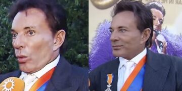 Gerard Joling reageert fel en haalt uit na kritiek op nieuw uiterlijk