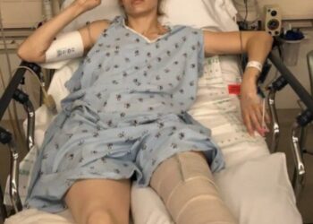 Model verliest haar benen door alledaags huishoudproduct ze waarschuwt nu vrouwen wereldwijd.