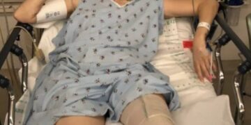 Model verliest haar benen door alledaags huishoudproduct ze waarschuwt nu vrouwen wereldwijd.