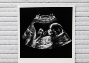 Babynieuws! Bij déze bekende familie is een baby op komst