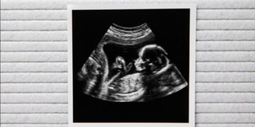 Babynieuws! Bij déze bekende familie is een baby op komst