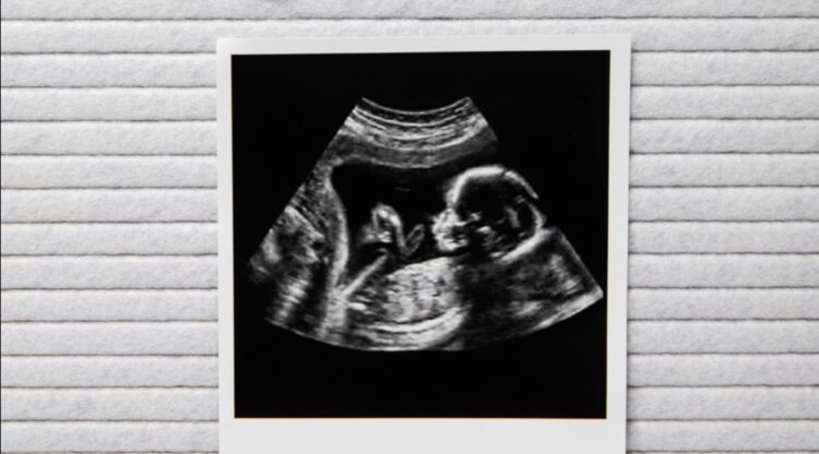 Babynieuws! Bij déze bekende familie is een baby op komst