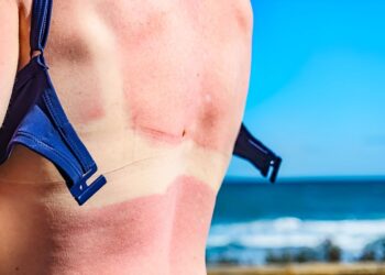 Consumentenbond waarschuwt: gebruik deze zonnebrandcrèmes niet – “Kans op huidkanker”