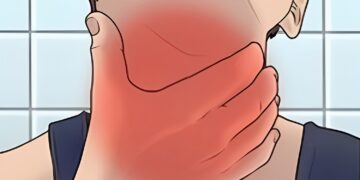 Dringende waarschuwing nu gevallen van de zeer besmettelijke ‘bull-neck’ infectie zich snel over Europa verspreiden