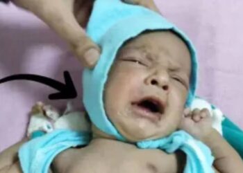 Verschrikkelijke vondst: pasgeboren baby met steen in mond en lipjes dichtgelijmd aangetroffen