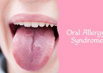 Steeds meer mensen krijgen klachten na fruit of noten: dit moet je weten over het Oraal Allergie Syndroom
