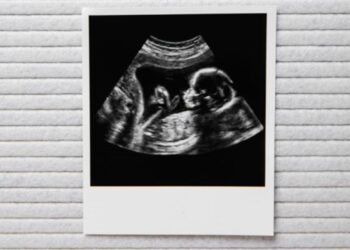 Geweldig babynieuws voor deze bekende Nederlander!