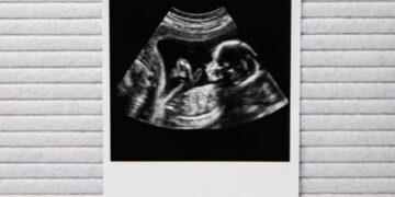 Geweldig babynieuws voor deze bekende Nederlander!