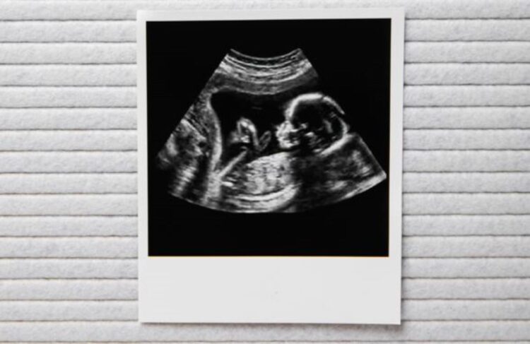 Geweldig babynieuws voor deze bekende Nederlander!