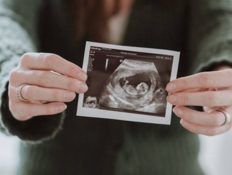 Geweldig babynieuws voor deze Nederlandse reality ster!