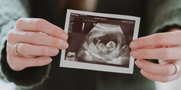 Babynieuws voor dit Nederlandse realitykoppel “Als ik raak schiet, schiet ik raak”