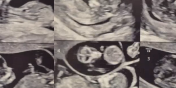 Dit koppel begint 2026 met een vierling, hun namen… zeer bijzonder en starten allemaal met een ‘X’