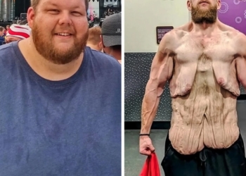 Van 163 kilo zwaarder naar compleet ander leven in twee jaar