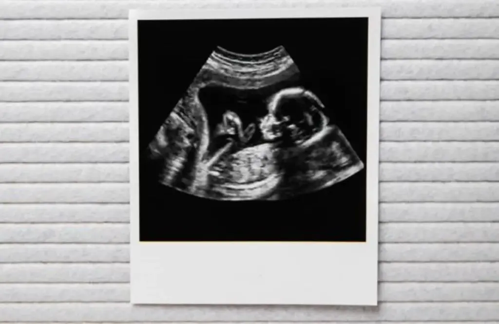 Geweldig babynieuws voor deze bekende actrice (52