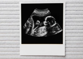 Geweldig babynieuws voor deze bekende actrice (52