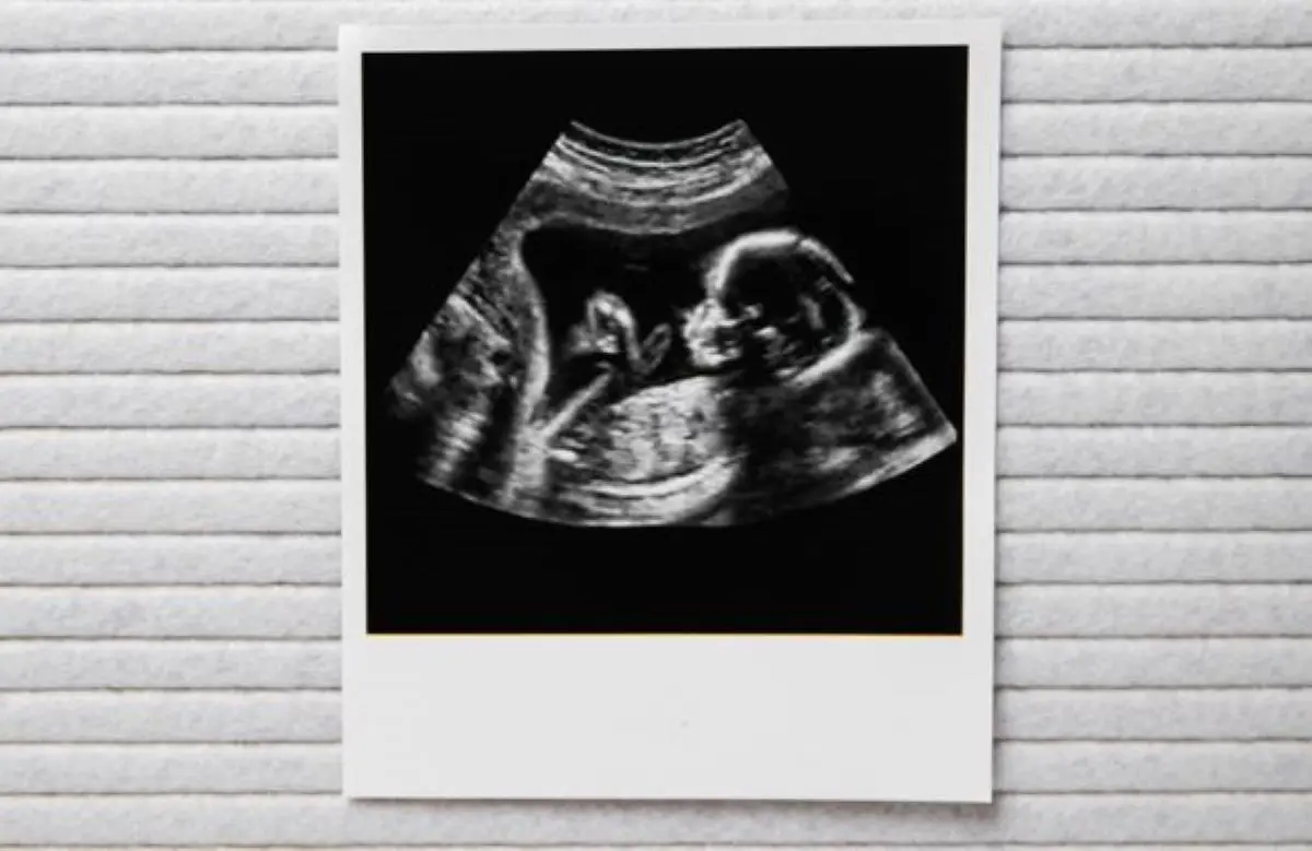 Geweldig babynieuws voor deze bekende actrice (52